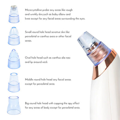 Electric Micro crystalline Pimple and Blackhead Remover