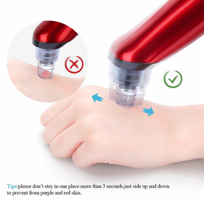 Electric Micro crystalline Pimple and Blackhead Remover